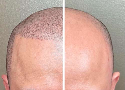 Micro con efecto de pelo corto ejemplo 6