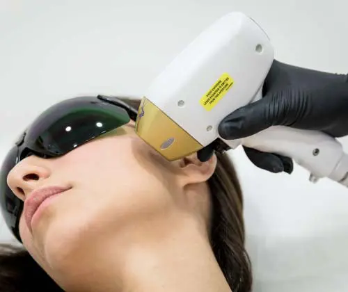 Laser diodo Soprano SHR