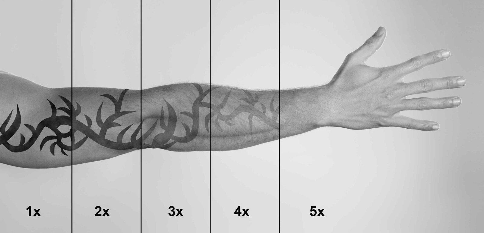ETAPAS PARA QUITAR TATUAJEs CON LÁSER