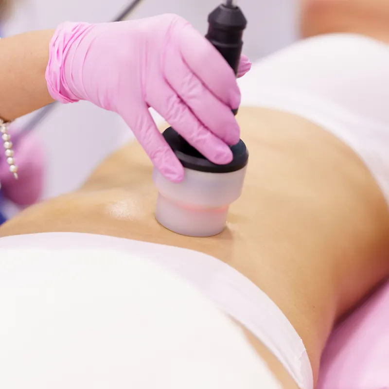 Remodelacion corporal 2 Radiofrecuencia corporal en el abdomen para reafirmar y reducir volumen