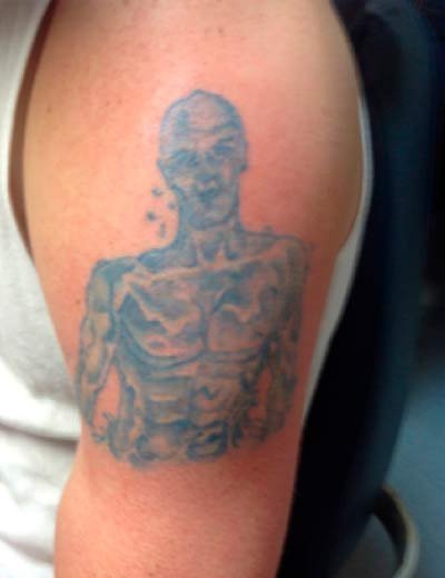 Eliminación de tatuaje con láser en Granada, caso 12: antes